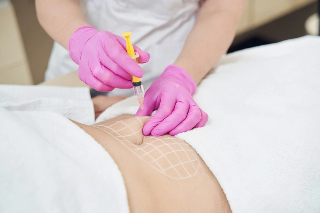 Szkolenie : Lipoliza iniekcyjna